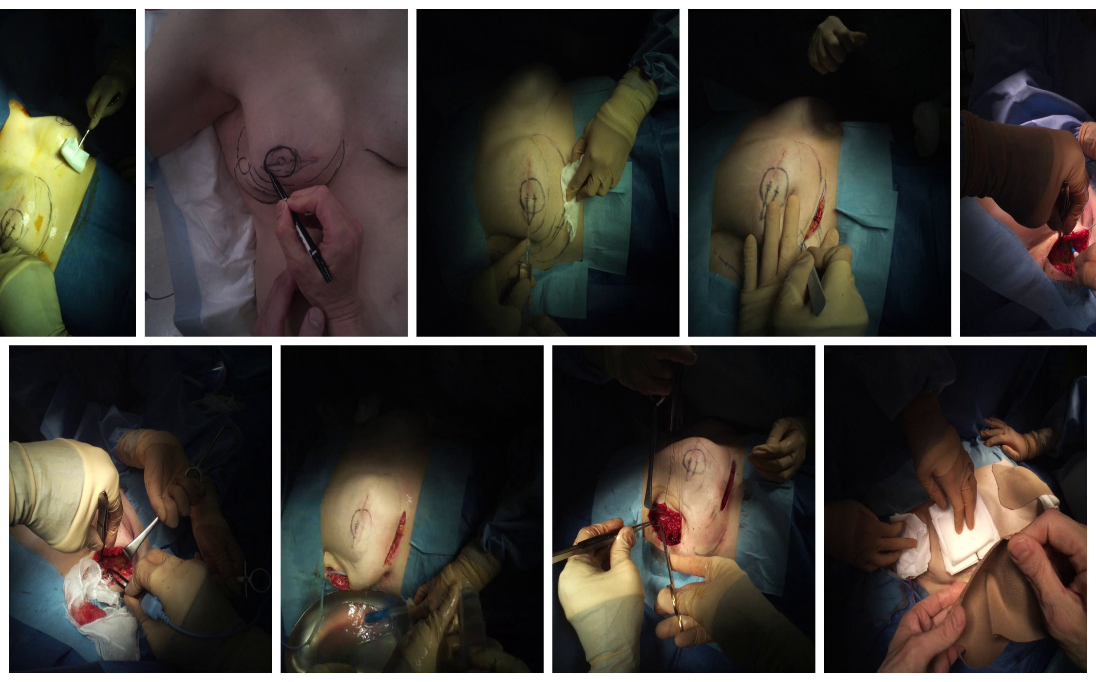 egosurgery-phase.png